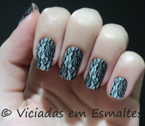 unhas