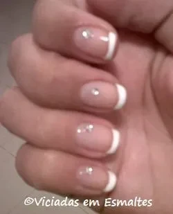 unhas